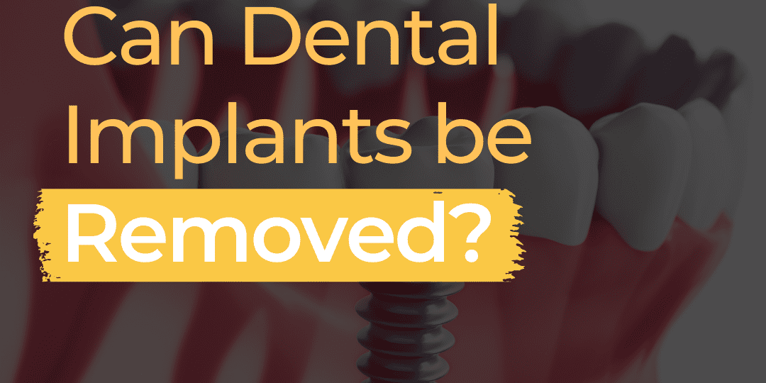 Can Dental Implants be removed? Dr Gurs Sehmi
